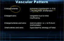 How to interpret thoracic radiographs