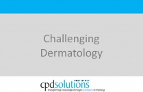 Challenging Dermatology
