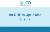 An ODE to Optic Disc Edema