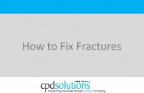 How to Fix Fractures