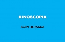 Rinoscopia