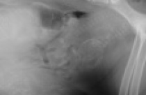 Imaging the Abdomen Webinar 2: Urogenital tract and the small bits