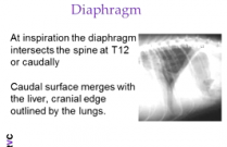 How to Read Radiographs