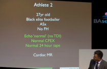Differentiating Athlete's Hearts from Cardiomyopathies