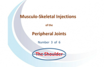 Injections around the Shoulder