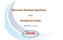 Injection around the hip
