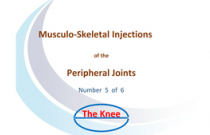 Injection/Aspiration of the knee